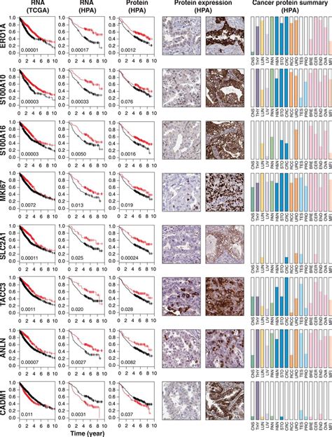 A Pathology Atlas Of The Human Cancer Transcriptome Science