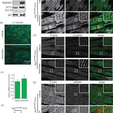 Cardiomyocyte Specific Knockout Of Atg In Mice A The Atg Protein