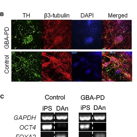 Generation And Characterization Of Ipsc Derived Dopaminergic Neuronal