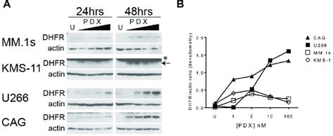 Antifolate Resistance In Hmcls Correlates To The Magnitude Of Dhfr