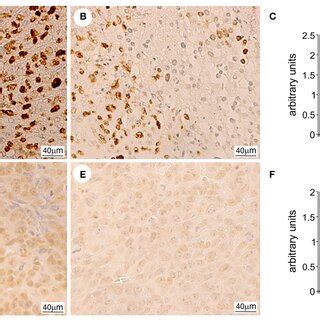 Representative Images Of The Immunohistochemical Analysis Of Ki 67