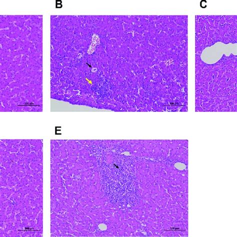 Effect Of AdipoRon On Histopathological Changes Of Geese Liver H E