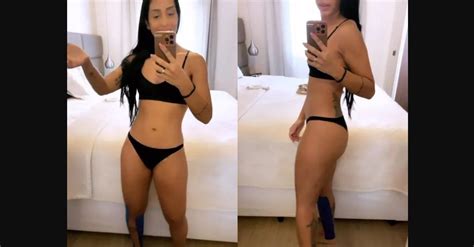 Amanda Djehdian mostra resultados 15 dias após cirurgia de lipedema