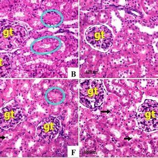 Representative Photographs Of Rat Renal Cortex By Light Microscope