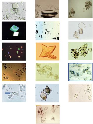 AUBF URINE SEDIMENTS Flashcards Quizlet