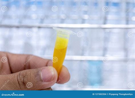 Analysis Protein for Study in Laboratory. Stock Photo - Image of glassware, medicine: 127302204