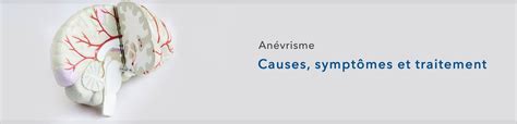 Anévrisme causes symptômes et traitements SHOP PHARMACIE