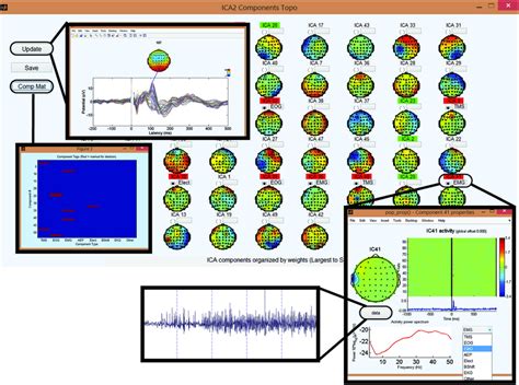 Illustration Of The Capability Of Tmseeg In Processing Several Types Of