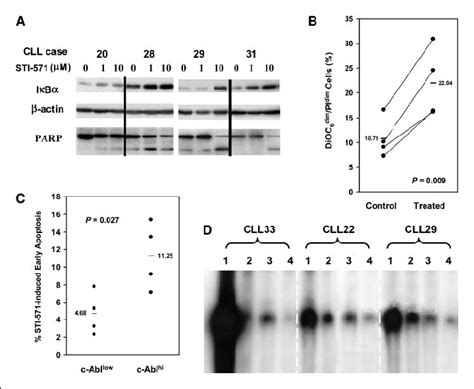 Sti 571 Induces Apoptosis Of Cll Cells With High Levels Of C Abl C Abl