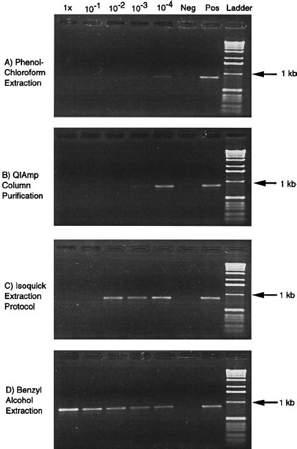 Amplification Controls Agarose Gel Electrophoresis Of Pcr Products