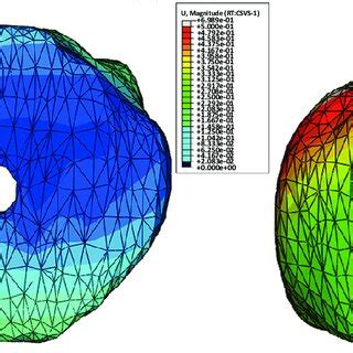 Axial View Of Three Dimensional Models Of Scaphoids With Herbert Type