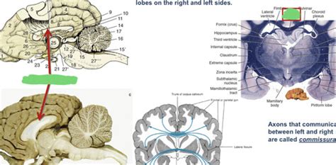 Mammalian Brain Anatomy Flashcards | Quizlet