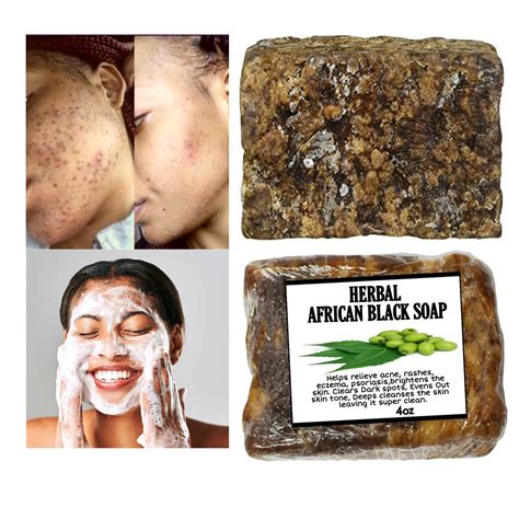 African Black Soap Herbal Black Soap Neem Soap Acne Soap Dark Spots