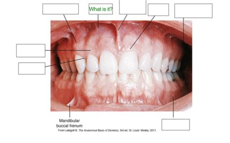 Practical 1 Orofacial Anatomy Flashcards Quizlet