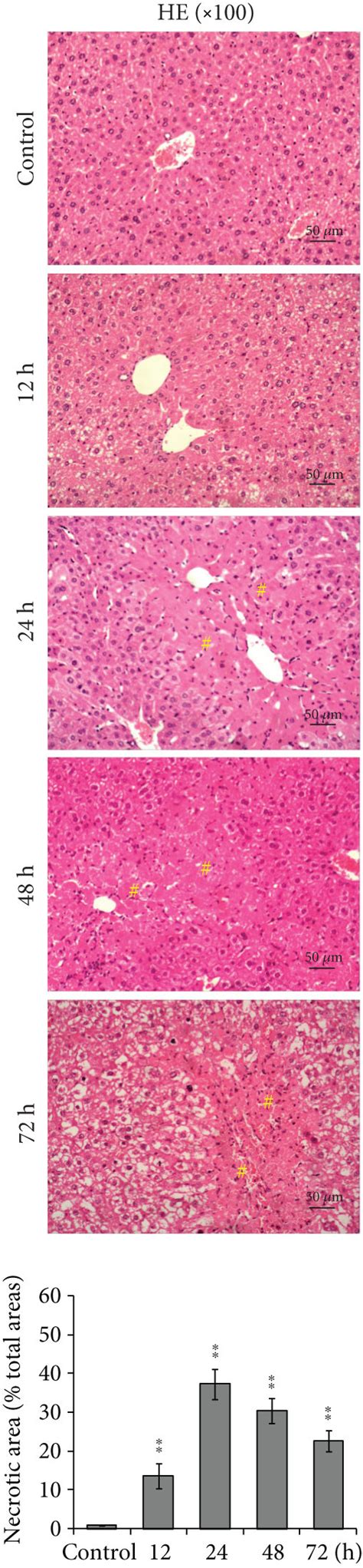 CCl4 Administration Induces Intrahepatic ER Stress And Apoptosis In