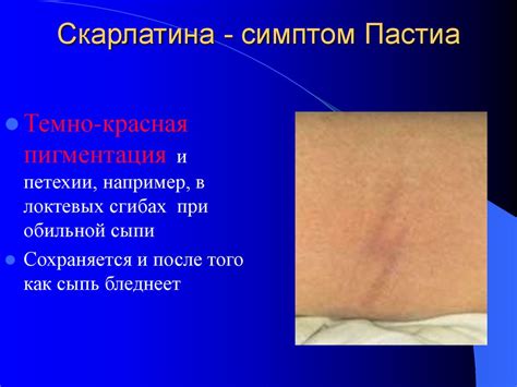 Внутрибольничные инфекции. Стрептококки - презентация онлайн