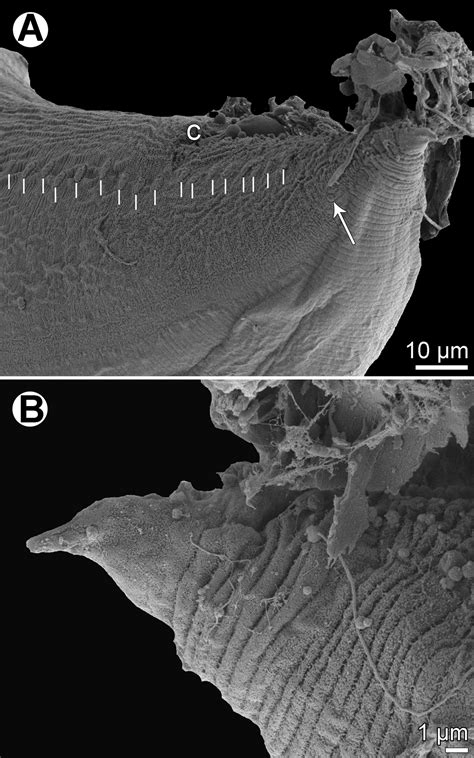 New records of anisakid nematodes from marine fishes off New Caledonia ...
