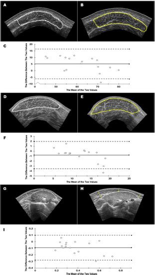 Jfmk Free Full Text The Influence Of Sonographer Experience On