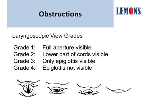 Upper Airway Assessment East Iv