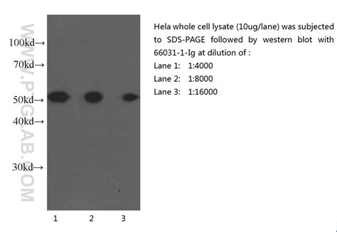 Tubulin Alpha Fusion Protein Ag Proteintech