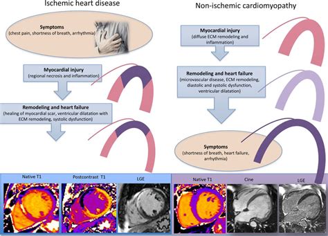 T1 Mapping In Characterizing Myocardial Disease Circulation Research