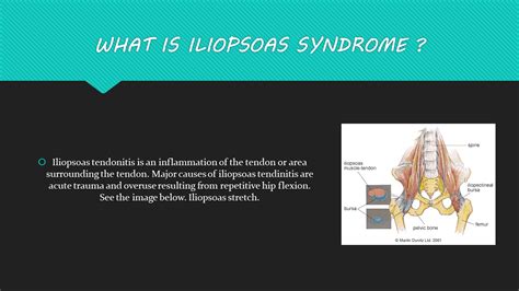 Wong Medical Centre Ipoh 黄氏医疗中心 Can Physiotherapy Help With Iliopsoas