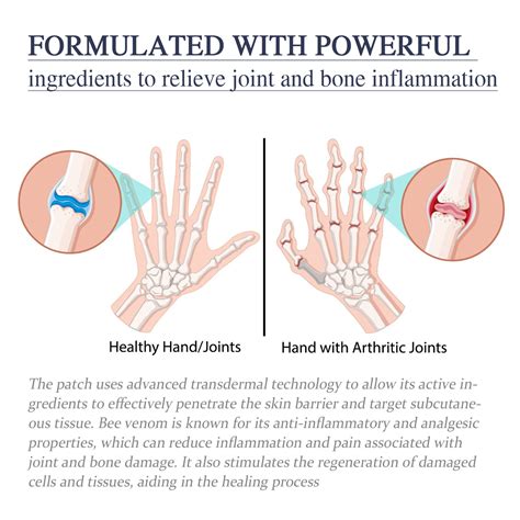 Bee venom joint ointment relieves pain in the lumbar spine, hands, feet