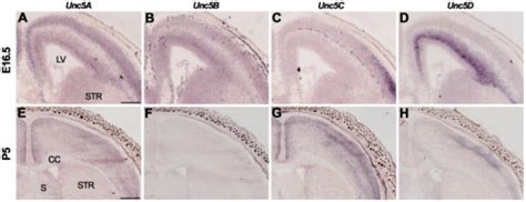 Unc Expression In The Cortex In Situ Hybridization On Open I