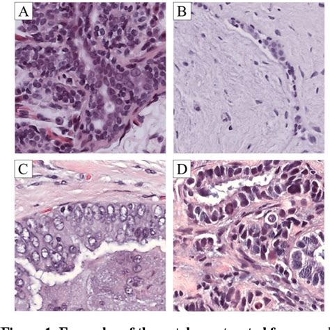 Figure 1 From Classification Of Breast Cancer Histology Images Using