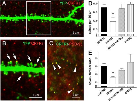 Correlated Memory Defects And Hippocampal Dendritic Spine Loss After