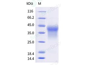 Recombinant Human HVEM Protein 10334 H49H B Sino Biological