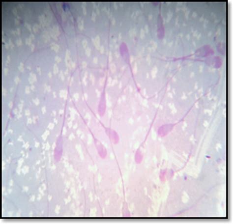 Spermatozoa With Intact Acrosome Reacted Giemsa Stain 100x Download Scientific Diagram