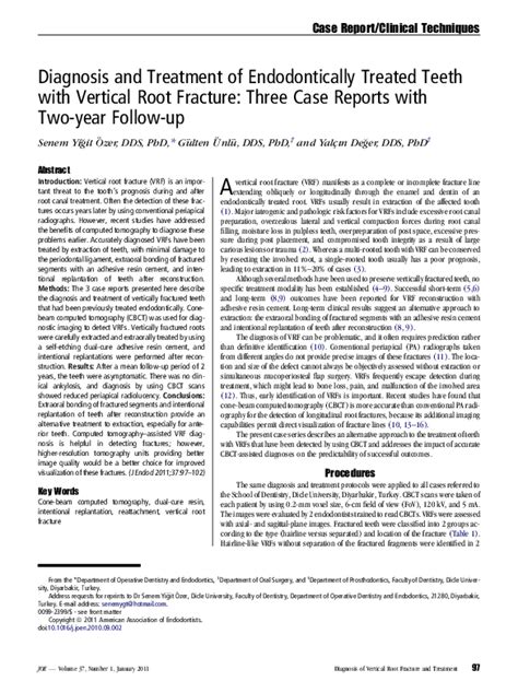 Pdf Diagnosis And Treatment Of Endodontically Treated Teeth With Vertical Root Fracture Three