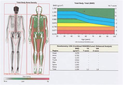 Analyzing Your Body Composition With The Dexa Scan Test An Honest Review Midlife Rambler