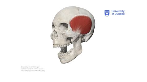 Temporalis Muscle - 3D model by University of Dundee, School of ...