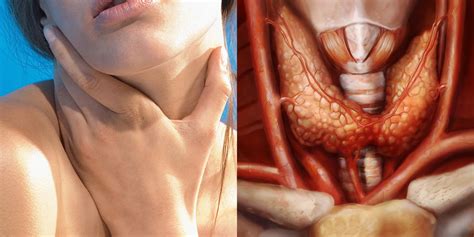 6 Common Thyroid Disorders And Their Causes | SELF