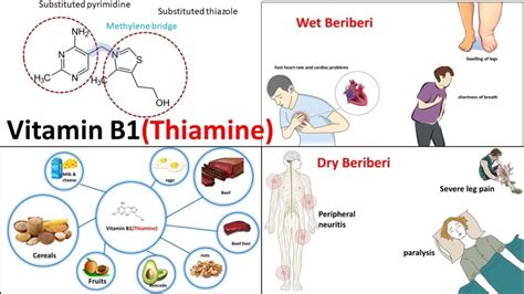 Benefits of Thiamine (Vitamin B1) » The Nutraceutical Database