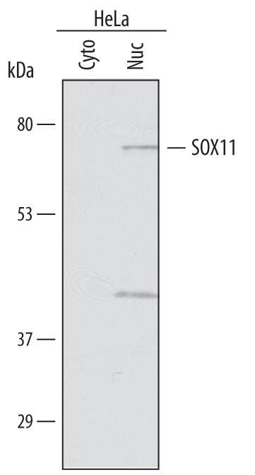 Human Sox11 Antibody Af3976 Randd Systems