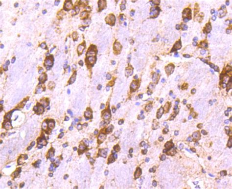 Calreticulin Recombinant Rabbit Monoclonal Antibody Su37 03 Invitrogen™ 100μl Unconjugated