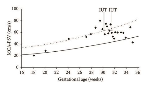 The Peak Systolic Flow Velocity Of The Fetal Middle Cerebral Artery Download Scientific Diagram