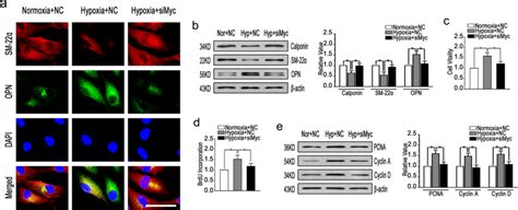 Myc Regulates Hypoxic Phenotypic Transition And Proliferation Of