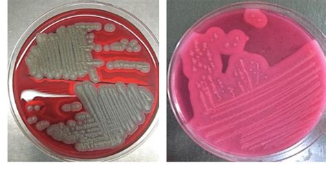 Bacillus Cereus Mannitol Salt Agar