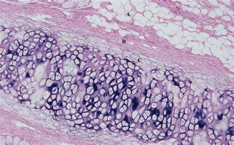 Elastic Cartilage Biology Simple