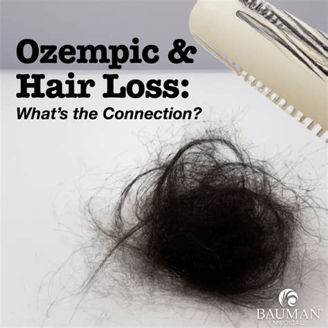 Understanding The Connection Does Ozempic Cause Hair Loss