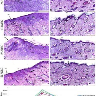 Photomicrographs Of The Masson Trichrome Stained Skin Sections In A