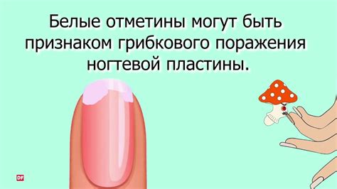 О чем говорят наши ногти? - YouTube