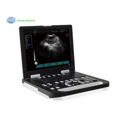 Clear Laptop Veterinary Diagnostic Ultrasound Vet Ultrasound Price With