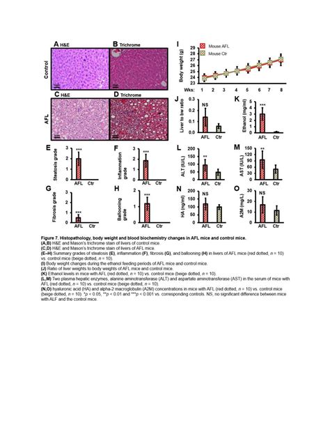 Cis F Fluoro L Proline Pet Ct Molecular Imaging Quantifying Liver