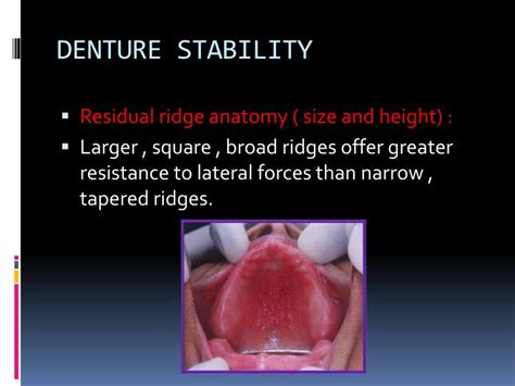 Ppt Dsp 332 Principles Of Complete Denture Prosthodontics Powerpoint