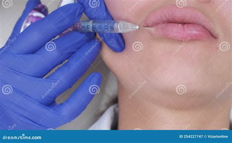 Closeup Of Botox Lip Injection Using Syringe Stock Video Video Of